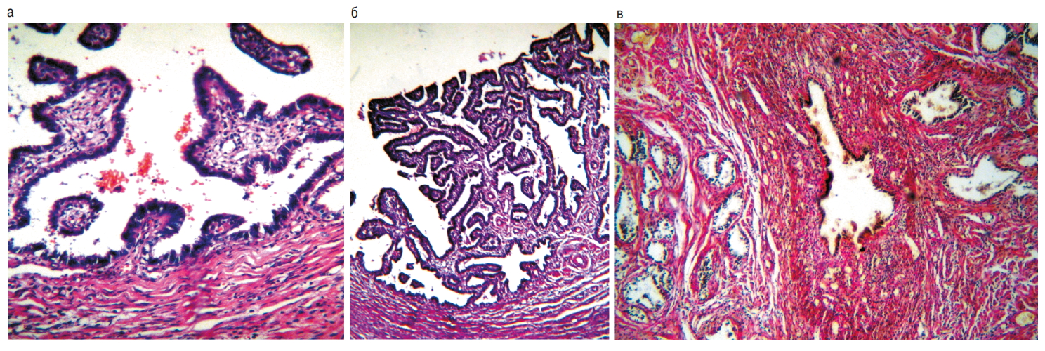 Гистология при беременности